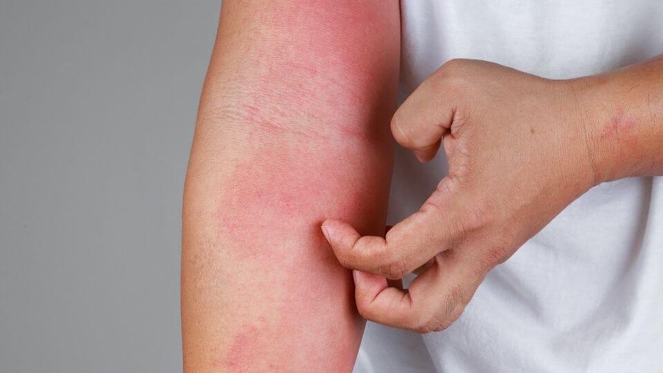 Best Allergy Doctor In Kathmandu