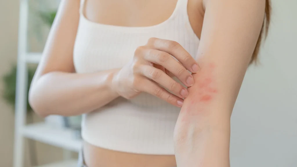 Best Allergy Treatment Services in Kathmandu