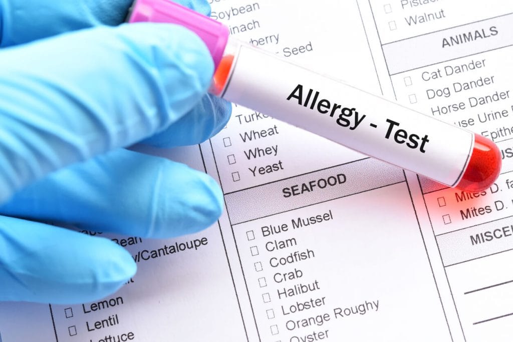 allergy test in nepal